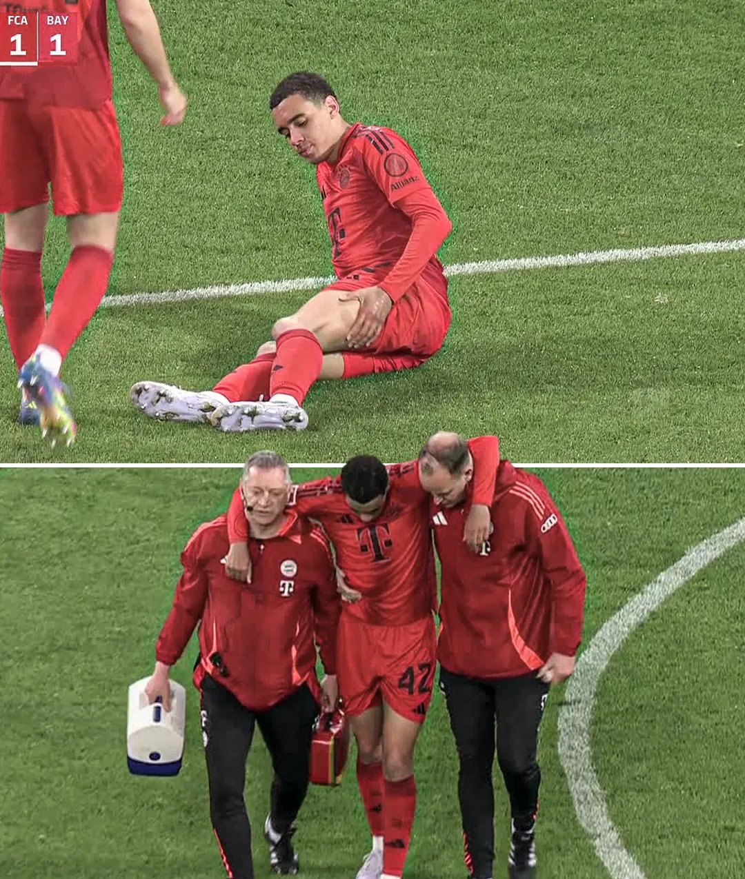 包含拜仁队球员受伤，影响全队士气的词条